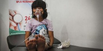 Asap Karhutla Buat 13 Ribu Warga Tanah Datar Menderita ISPA