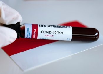 Apa Itu Rapid Test untuk Virus Corona?