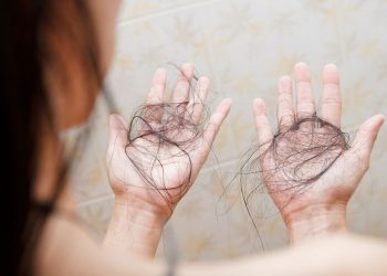 Cegah Rambut Rontok Berlebihan, Lakukan 5 Perubahan Gaya Hidup Ini
