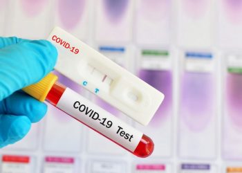 104 Warga Petamburan Ikut Rapid Test Massal, 5 Orang Reaktif Covid-19