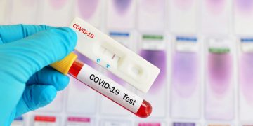104 Warga Petamburan Ikut Rapid Test Massal, 5 Orang Reaktif Covid-19