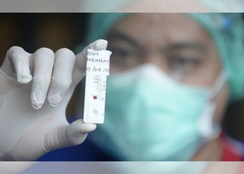 Simak Beda Rapid Test Antigen dan Antibodi