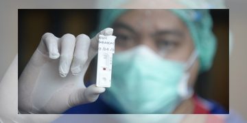 Simak Beda Rapid Test Antigen dan Antibodi