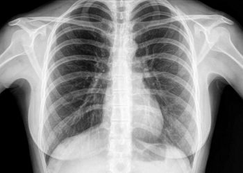 Ingin Paru-Paru Sehat di Masa Pandemi Covid19? Simak Ulasan Lengkapnya