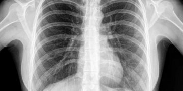 Ingin Paru-Paru Sehat di Masa Pandemi Covid19? Simak Ulasan Lengkapnya