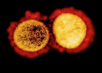 Virus Corona Mutasi Rusia Ditemukan di Australia