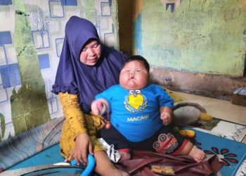 Viral, Bayi Usia 18 Bulan Memiliki Berat 27 kg di Bekasi