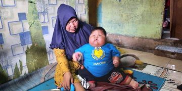 Viral, Bayi Usia 18 Bulan Memiliki Berat 27 kg di Bekasi