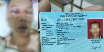 Kejadian Sadis Terjadi Lagi di Wamena, Andi Silaban, Dibegal Orang Tak Dikenal