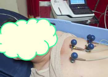 Kinerja Polresta Tanjungpinang Dipertanyakan, Korban Pengeroyokan di KTV Kritis 3 hari di UGD – Pelakunya Masih Bebas