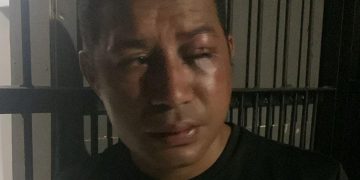 Keroyok Aktivis, Sejumlah Anggota Polisi di Papua Barat Resmi Dipolisikan