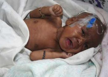 Pemeriksaan HIV Bayi di Papua Barat Terhambat, Komite III DPD RI Desak Kemenkes Bertindak